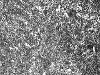 ツルースタイト組織　山本化学工具